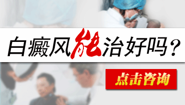 小孩子患上了白癜风可以根治吗